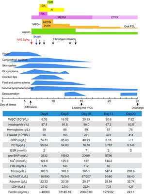 Kawasaki disease complicated with shock syndrome, macrophage activation syndrome, and acute abdomen in children: Two case reports